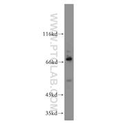 PLAGL2 Rabbit Polyclonal Antibody (11540-1-AP)