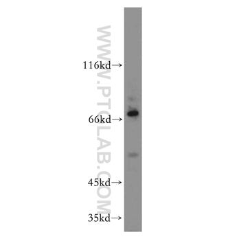 PLAGL2 Rabbit Polyclonal Antibody (11540-1-AP)