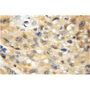 BCL11A Rabbit Polyclonal Antibody (11613-1-AP)