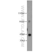 ACTG1 Rabbit Polyclonal Antibody (11227-1-AP)
