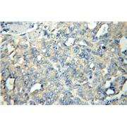 FLCN Rabbit Polyclonal Antibody (11236-2-AP)