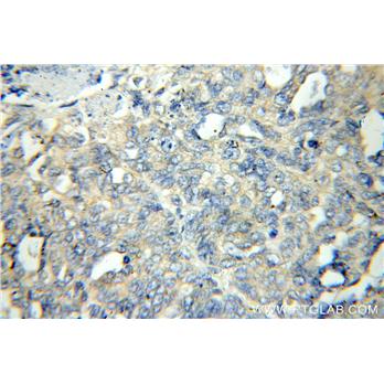 FLCN Rabbit Polyclonal Antibody (11236-2-AP)