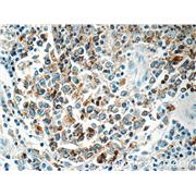 HLA-DPB1 Rabbit Polyclonal Antibody (11298-1-AP)