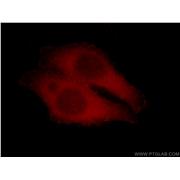 FERMT2 Rabbit Polyclonal Antibody (11453-1-AP)