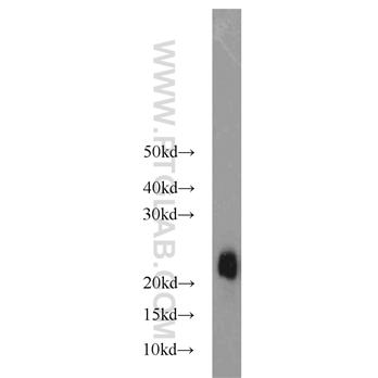 STMN3 Rabbit Polyclonal Antibody (11311-1-AP)