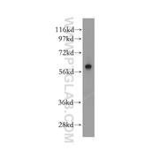 PARP3 Rabbit Polyclonal Antibody (11289-1-AP)