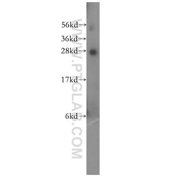 RABL2B Rabbit Polyclonal Antibody (11588-1-AP)