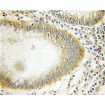 ATG12 Rabbit Polyclonal Antibody (11264-1-AP)