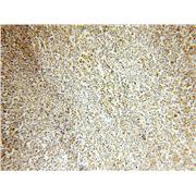 WHSC1L1 Rabbit Polyclonal Antibody (11345-1-AP)