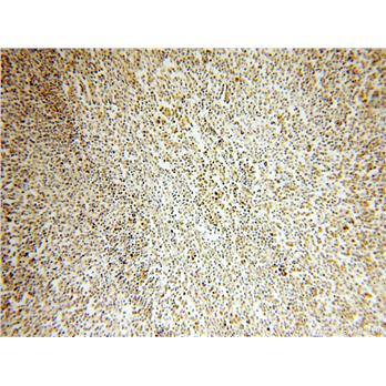WHSC1L1 Rabbit Polyclonal Antibody (11345-1-AP)