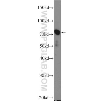EFHC1 Rabbit Polyclonal Antibody (11471-1-AP)