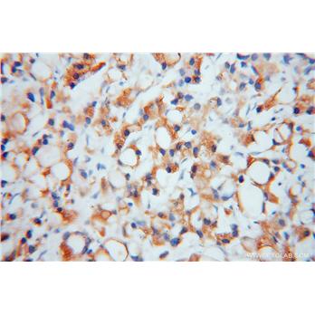 EIF2A Rabbit Polyclonal Antibody (11233-1-AP)