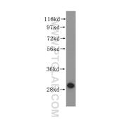 ECHS1 Rabbit Polyclonal Antibody (11305-1-AP)