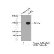 PSMC3IP Rabbit Polyclonal Antibody (11339-1-AP)