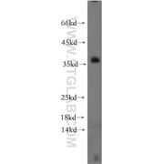 LAT Rabbit Polyclonal Antibody (11326-1-AP)