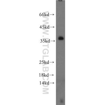 LAT Rabbit Polyclonal Antibody (11326-1-AP)