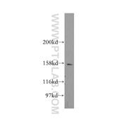CENPJ Rabbit Polyclonal Antibody (11517-1-AP)