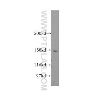CENPJ Rabbit Polyclonal Antibody (11517-1-AP)