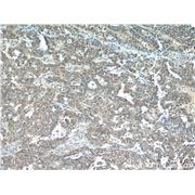 MLH1 Rabbit Polyclonal Antibody (11697-1-AP)