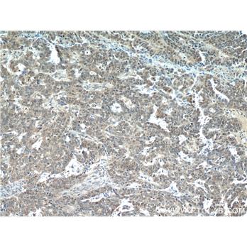 MLH1 Rabbit Polyclonal Antibody (11697-1-AP)