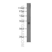 RARG Rabbit Polyclonal Antibody (11424-1-AP)