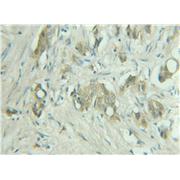 RAB9A Rabbit Polyclonal Antibody (11420-1-AP)