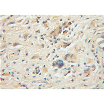 PPP5C Rabbit Polyclonal Antibody (11715-1-AP)