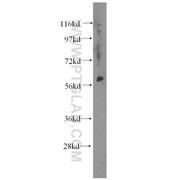 DDX28 Rabbit Polyclonal Antibody (11617-1-AP)
