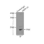 ARPP-19 Rabbit Polyclonal Antibody (11678-1-AP)