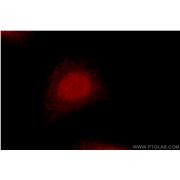 GAR1 Rabbit Polyclonal Antibody (11711-1-AP)