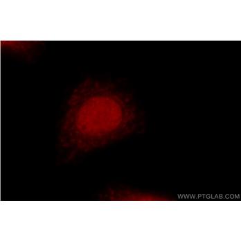 GAR1 Rabbit Polyclonal Antibody (11711-1-AP)
