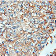 IFITM3 Rabbit Polyclonal Antibody (11714-1-AP)