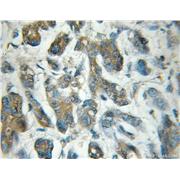 EIF5 Rabbit Polyclonal Antibody (11155-1-AP)