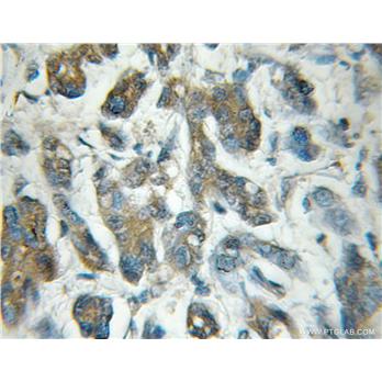 EIF5 Rabbit Polyclonal Antibody (11155-1-AP)