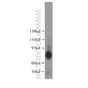TACC2 Rabbit Polyclonal Antibody (11407-1-AP)