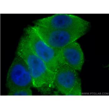 ANXA2 Rabbit Polyclonal Antibody (11256-1-AP)