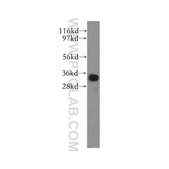 MND1 Rabbit Polyclonal Antibody (11636-1-AP)
