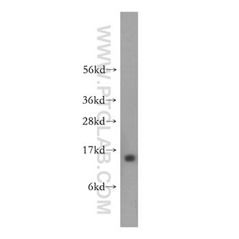HMGN4 Rabbit Polyclonal Antibody (11686-1-AP)