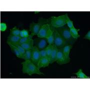S100A16 Rabbit Polyclonal Antibody (11456-1-AP)