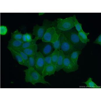 S100A16 Rabbit Polyclonal Antibody (11456-1-AP)