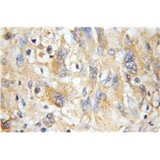 NMT1 Rabbit Polyclonal Antibody (11546-1-AP)