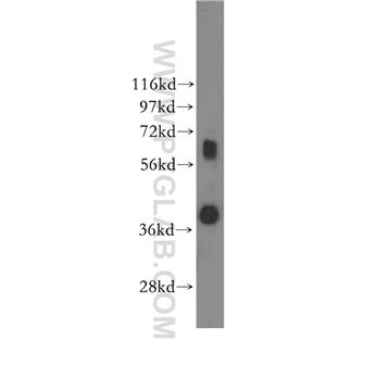 SPRY2 Rabbit Polyclonal Antibody (11383-1-AP)