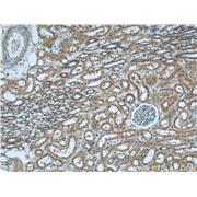 GNAI3 Rabbit Polyclonal Antibody (11641-1-AP)