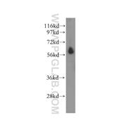 STK32C Rabbit Polyclonal Antibody (11434-1-AP)