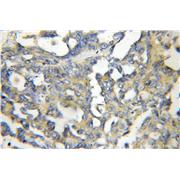 HPS6 Rabbit Polyclonal Antibody (11371-1-AP)