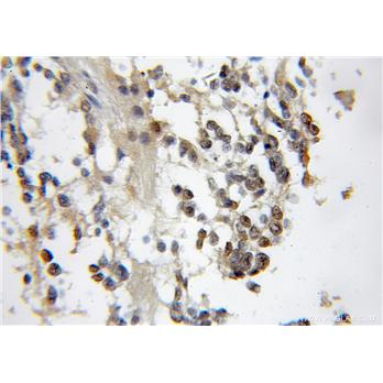 CBFA2T2 Rabbit Polyclonal Antibody (11336-1-AP)