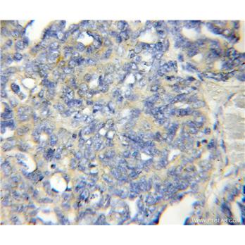 LENG1 Rabbit Polyclonal Antibody (11406-1-AP)