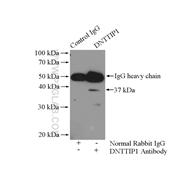 DNTTIP1 Rabbit Polyclonal Antibody (11637-1-AP)
