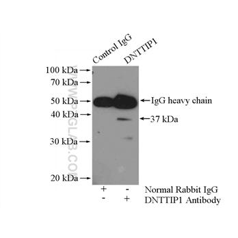 DNTTIP1 Rabbit Polyclonal Antibody (11637-1-AP)
