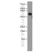 TTC1 Rabbit Polyclonal Antibody (11676-1-AP)